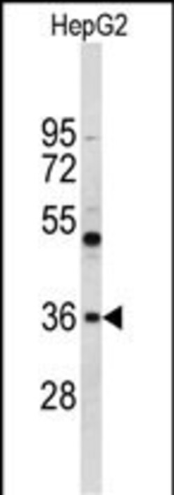 Invitrogen ELOVL2 Polyclonal Antibody 400 &mu;L; Unconjugated:Antibodies,
