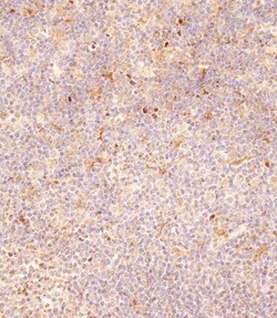 Invitrogen FCGR1B Polyclonal Antibody 400 &mu;L; Unconjugated:Antibodies,