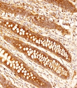 Invitrogen FCGR1B Polyclonal Antibody 400 &mu;L; Unconjugated:Antibodies,