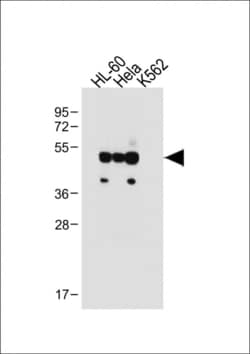 Invitrogen FCGR1B Polyclonal Antibody 400 &mu;L; Unconjugated:Antibodies,