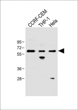 Invitrogen FCGR1B Polyclonal Antibody 400 &mu;L; Unconjugated:Antibodies,