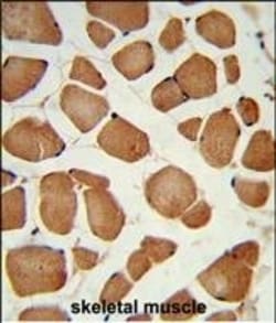 Invitrogen ANGPTL4 Polyclonal Antibody 400 &mu;L; Unconjugated:Antibodies,