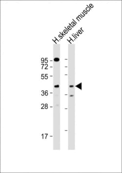 Invitrogen ANGPTL4 Polyclonal Antibody 400 &mu;L; Unconjugated:Antibodies,