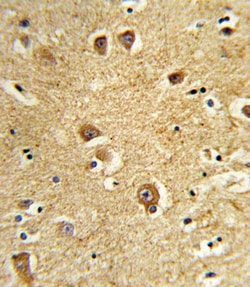 Invitrogen SLC22A6 Polyclonal Antibody 400 &mu;L; Unconjugated:Antibodies,