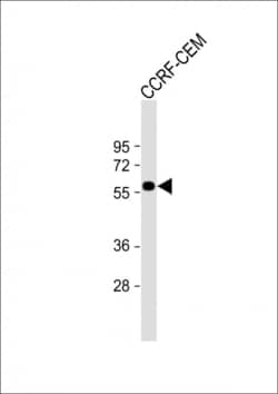 Invitrogen SLC22A6 Polyclonal Antibody 400 &mu;L; Unconjugated:Antibodies,