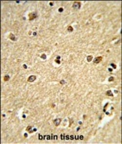 Invitrogen PLCB2 Polyclonal Antibody 400 &mu;L; Unconjugated:Antibodies,