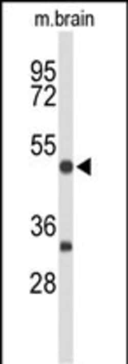 Invitrogen MEF2A Polyclonal Antibody 400 &mu;L | Buy Online | Invitrogen&trade; | Fisher Scientific