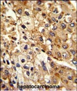ATP1B2 Polyclonal Antibody:Antibodies, Polyclonal
