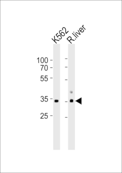 ATP1B2 Polyclonal Antibody:Antibodies, Polyclonal