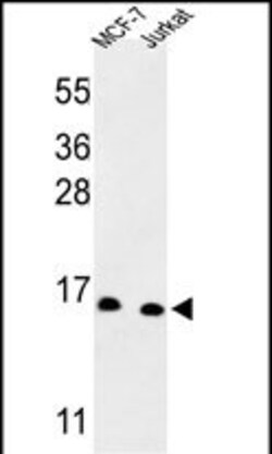 Invitrogen SNRPD3 Polyclonal Antibody 400 μL; Unconjugated:Antibodies,