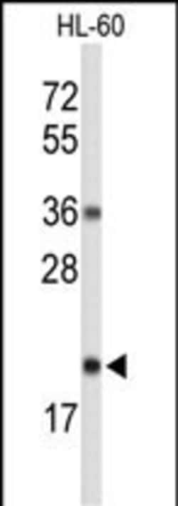 RNaseH2C Polyclonal Antibody:Antibodies, Polyclonal