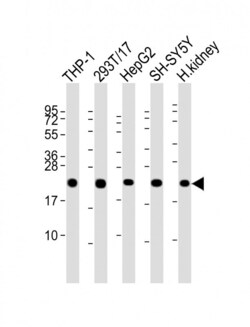 Invitrogen GPX1 Polyclonal Antibody 400 &mu;L; Unconjugated:Antibodies,