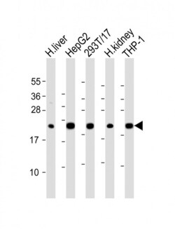 Invitrogen GPX1 Polyclonal Antibody 400 &mu;L; Unconjugated:Antibodies,