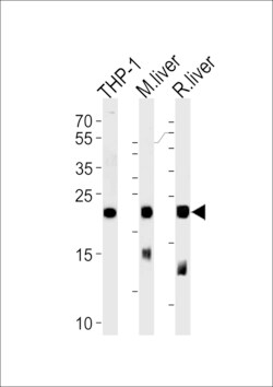 Invitrogen GPX1 Polyclonal Antibody 400 &mu;L; Unconjugated:Antibodies,