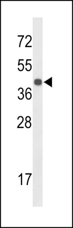 Invitrogen CENPK Polyclonal Antibody 400 &mu;L; Unconjugated:Antibodies,