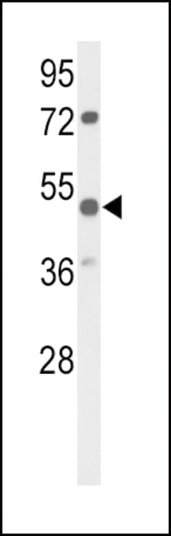 Invitrogen PARVA Polyclonal Antibody 400 &mu;L; Unconjugated:Antibodies,