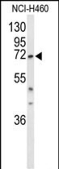 Invitrogen DDX17 Polyclonal Antibody 400 &mu;L; Unconjugated:Antibodies,