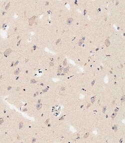 Invitrogen DLL3 Polyclonal Antibody 200 &mu;L; Unconjugated:Antibodies,