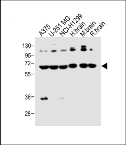 Invitrogen DLL3 Polyclonal Antibody 200 &mu;L; Unconjugated:Antibodies,