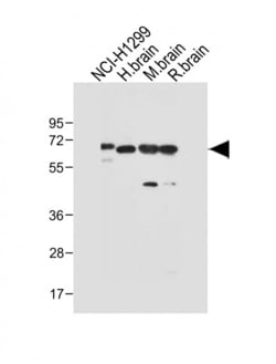 Invitrogen DLL3 Polyclonal Antibody 200 &mu;L; Unconjugated:Antibodies,