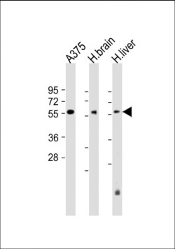 Invitrogen DLL3 Polyclonal Antibody 200 &mu;L; Unconjugated:Antibodies,