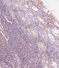 Invitrogen GUSB Polyclonal Antibody 400 &mu;L; Unconjugated:Antibodies,