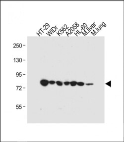 Invitrogen GUSB Polyclonal Antibody 400 &mu;L; Unconjugated:Antibodies,