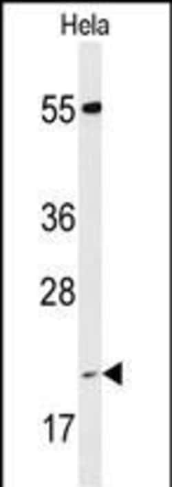 Invitrogen Cyclophilin C Polyclonal Antibody 400 &mu;L; Unconjugated:Antibodies,