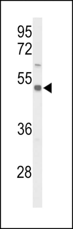 SLC39A8 Polyclonal Antibody:Antibodies, Polyclonal