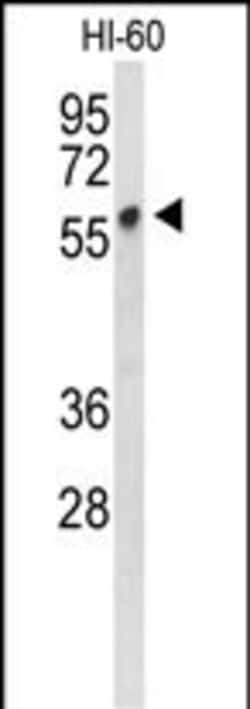Invitrogen PLVAP Polyclonal Antibody 400 &mu;L; Unconjugated:Antibodies,
