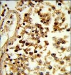 Invitrogen IL-31 Polyclonal Antibody 400 &mu;L; Unconjugated:Antibodies,