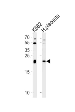 Invitrogen IL-31 Polyclonal Antibody 400 &mu;L; Unconjugated:Antibodies,
