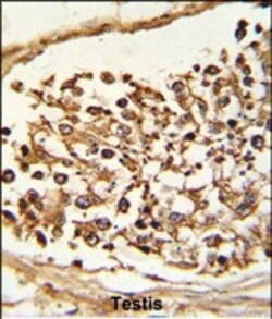 Invitrogen JMJD2B Polyclonal Antibody 400 &mu;L; Unconjugated:Antibodies,