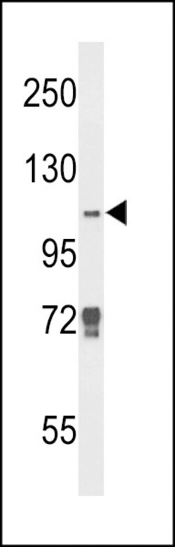 Invitrogen JMJD2B Polyclonal Antibody 400 &mu;L; Unconjugated:Antibodies,