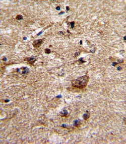 Invitrogen alpha-1b Adrenergic Receptor Polyclonal Antibody 400 &mu;L;