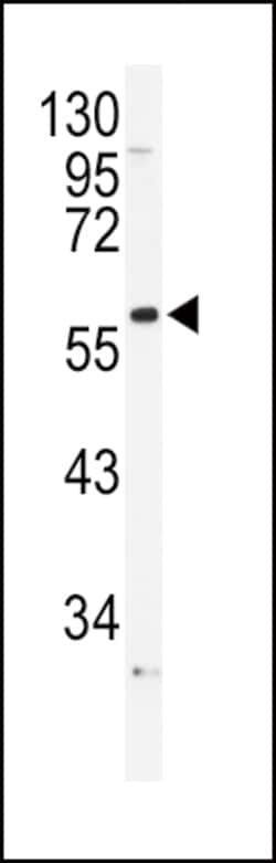 Invitrogen alpha-1b Adrenergic Receptor Polyclonal Antibody 400 &mu;L;