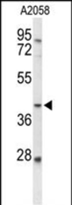 FUT3 Polyclonal Antibody:Antibodies, Polyclonal