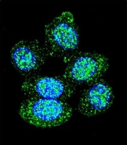 Acid Phosphatase 1 Polyclonal Antibody:Antibodies, Polyclonal