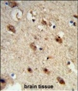 Acid Phosphatase 1 Polyclonal Antibody:Antibodies, Polyclonal