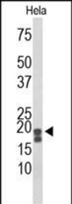 Acid Phosphatase 1 Polyclonal Antibody:Antibodies, Polyclonal