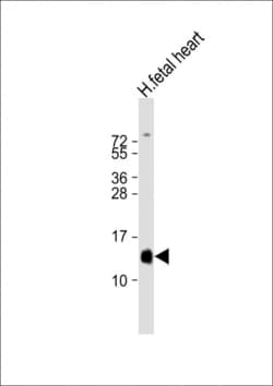 Invitrogen HBA2 Polyclonal Antibody 200 μL; Unconjugated:Antibodies,