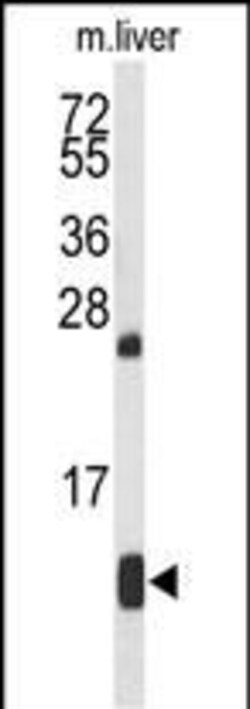 Invitrogen HBA2 Polyclonal Antibody 200 μL; Unconjugated:Antibodies,