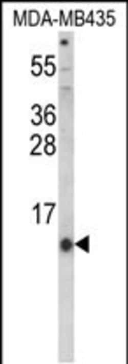 Invitrogen HAMP Polyclonal Antibody 400 &mu;L; Unconjugated:Anticuerpos