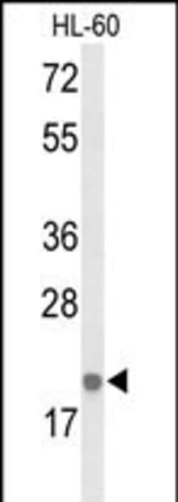 IL-26 Polyclonal Antibody:Antibodies, Polyclonal
