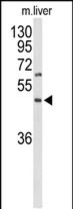 Invitrogen GPR160 Polyclonal Antibody 400 &mu;L; Unconjugated:Antibodies,