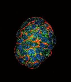 Invitrogen GBE1 Polyclonal Antibody 400 &mu;L; Unconjugated:Antibodies,