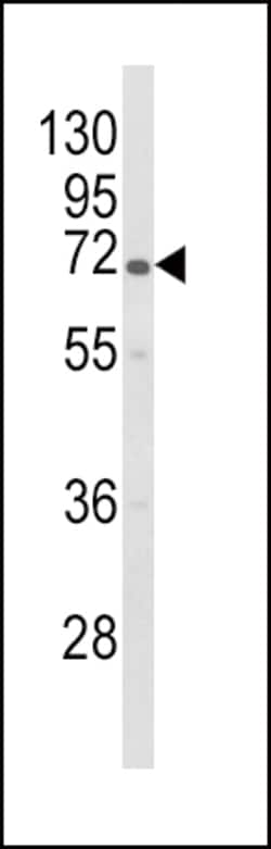 Invitrogen GBE1 Polyclonal Antibody 400 &mu;L; Unconjugated:Antibodies,