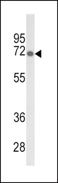 Invitrogen GBE1 Polyclonal Antibody 400 &mu;L; Unconjugated:Antibodies,