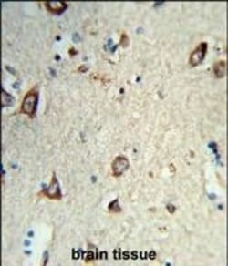 HS3ST2 Polyclonal Antibody:Antibodies, Polyclonal