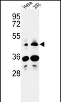 HS3ST2 Polyclonal Antibody:Antibodies, Polyclonal